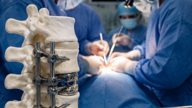 Revolutionary Back Surgery Implant Gains FDA Approval for Enhanced Recovery